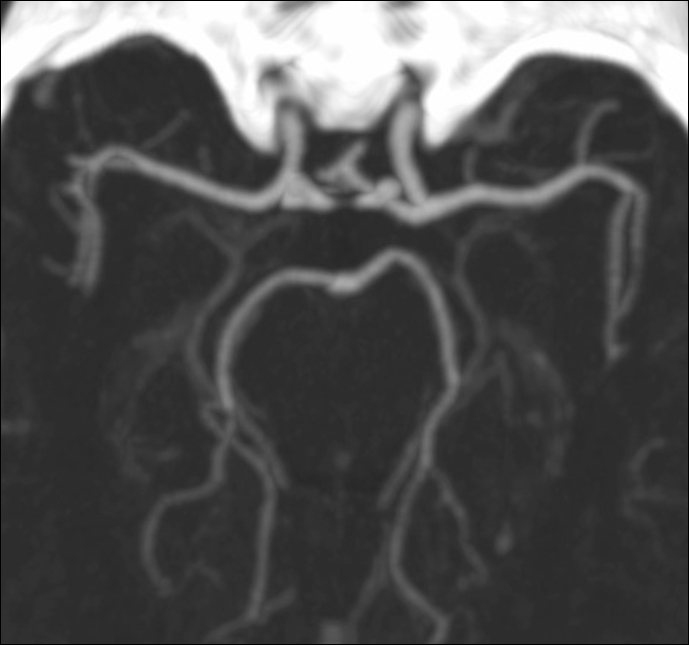 Slika 3a. CT-angiografija